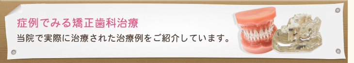 症例でみる矯正歯科治療